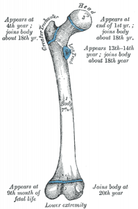 Картинка: Бедренная кость