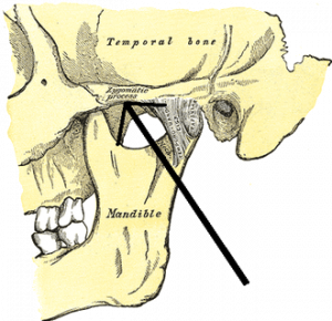 Картинка: Скуловая дуга